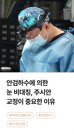 안검하수에 의한 눈 비대칭, 주시안 교정이 중요한 이유